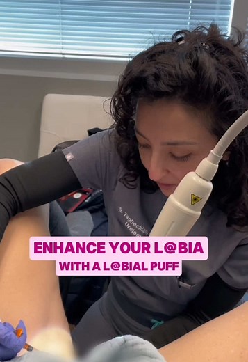 Labial Puff: Non-Surgical Intimate Aesthetic Treatment