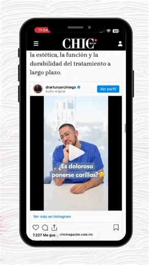 Arturo Arciniega Valverde on Instagram: "📰 Salí en @chic_mty hablando de carillas dentales y de algo que siempre repito en consulta: las carillas no son solo estética… son diagnóstico, planeación y salud primero. En la nota explico: ✔️ Qué son realmente las carillas ✔️ Quiénes sí son candidatos (y quiénes no) ✔️ Cómo cuidarlas para que duren muchos años Porque una sonrisa bonita no se improvisa. Se diseña con ciencia, experiencia y responsabilidad. Gracias Chic por abrir este espacio para habla