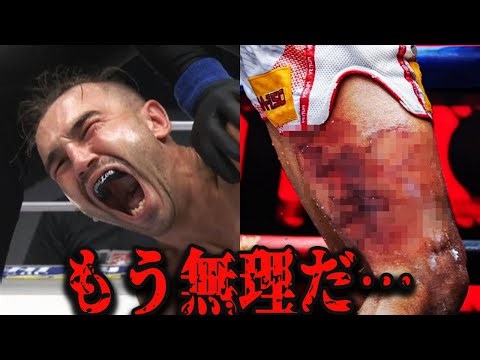 【衝撃】戦慄のキックKO！痛すぎて地獄・・・【格闘技/k1】