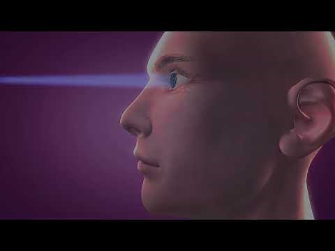 RxSight Light Adjustable Lens | How it Works | Cataract Surgery