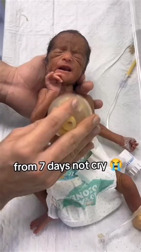 B.sc Nursing notes on Instagram: "What do you Think??💔 .. Like share comment guys... #newbody #newpost"