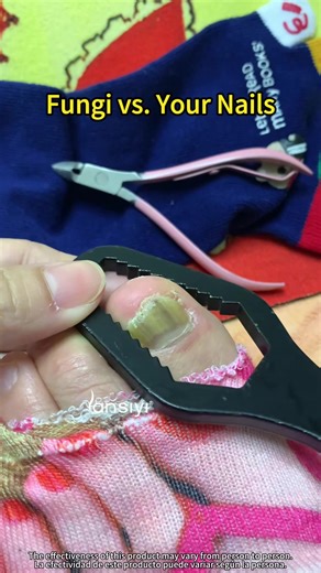 Effective Nail Care Patches for Fungus Relief