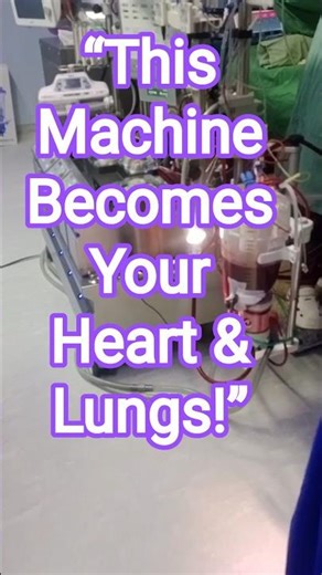 "This Machine Takes Over Your Heart & Lungs During Surgery! 🫀⚙️ #HeartSurgery"