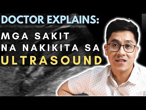 DOCTOR EXPLAINS: MAY BATO KA SA APDO?