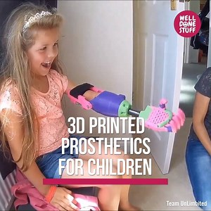 24K views · 385 reactions | These vibrantly colorful 3D-printed prosthetics are offered to kids for free | Well Done Stuff | Facebook