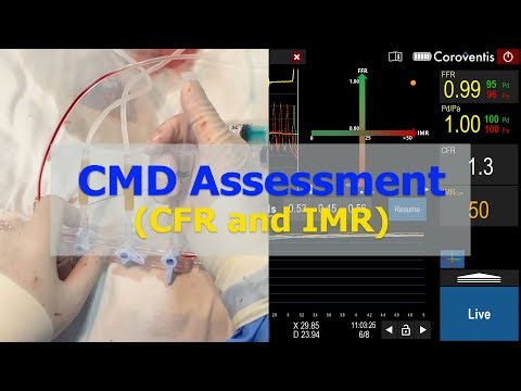 CMD Assessment (CFR and IMR)