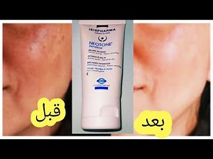 اليك الحل النهائي🔉اقوى كريم لازالة التصبغات والكلف والنمش⁉️ isispharma neotone اقوى كريم لتقشير