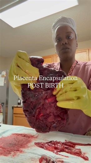 Queen Asha, MSW, RYT, Womb Practitioner & Full Spectrum Doula🇭🇹 on Instagram: "Placenta Encapsulation is ONE of the post birth placenta services we offer! Myself and my backup doula will arrive to your birthing center/hospital to pick up your placenta and get to work. Encapsulation has 5 steps: 1. Disinfection 2. Steaming 3. Dehydration 4. Blending and Powder Form 5. Pill transfer We use 100% Vegan capsules for all placenta pills & give you a clear bottle so you may track your usage. We also p