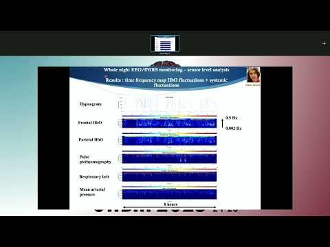 OHBM 2025 | Symposium | Christophe Grova | Simultaneous EEG – functional Near Infrared Spectroscop…