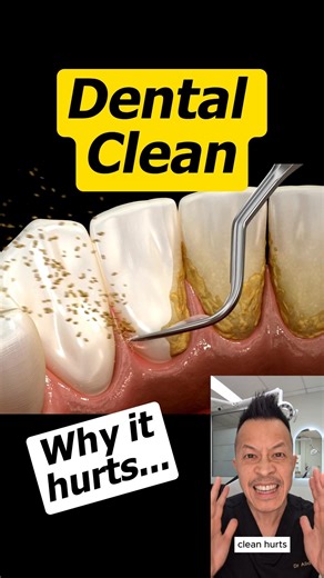 Dental Cleaning Pain Explained (And How to Make It Stop) #theeverydaydentist #dentist #shorts