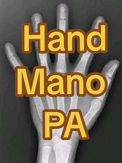 X-ray Technique for Hand Imaging in Radiology