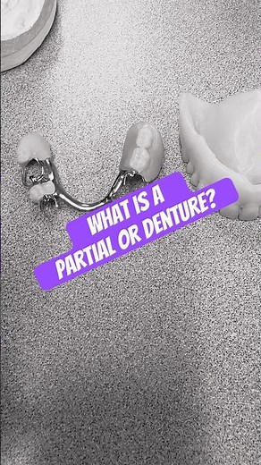 What’s is a partial or denture? #dentist #dentalassistant #teeth