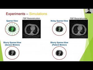 Beyond Local Processing: Adapting CNNs for CT Reconstruction