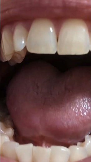 Teeth Tapping Mouth Tour #mouthsounds