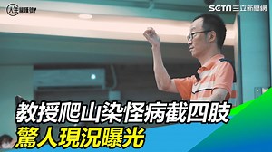 12 reactions | 「你能不能接受，接下來過一場完全不一樣的人生」教授在一次爬山之後，失去了他的四肢，在經過懷疑害怕後他重新站起來！ （ #小草西） 【精選回顧】鋼鐵教授／爬山染怪病截四肢、移植異體手臂　驚人現況曝光 採訪記者： 郭奕均 Maggie | 三立iNEWS | Facebook