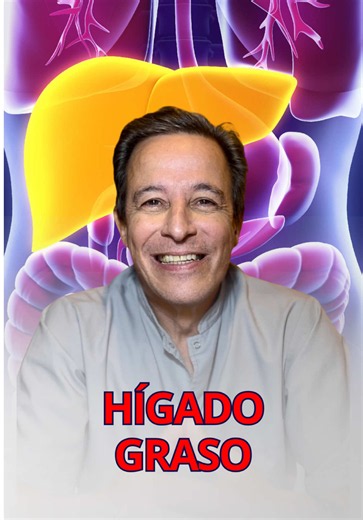 ➕PARA SABER MÁS👇 El hígado graso (esteatosis) es la acumulación de grasa en las células hepáticas, considerada patológica cuando supera el 5% del órgano. Su eje central es la resistencia a la insulina, que provoca una liberación excesiva de ácidos grasos y estimula la creación de grasa nueva en el hígado (lipogénesis de novo). Aunque suele ser asintomático, es un problema metabólico general que, de no corregirse, puede progresar a cirrosis o carcinoma. Factores de Riesgo y Causas • Alimentación