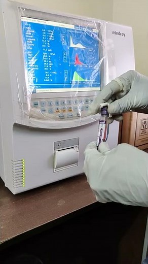 How To Run CBC Sample On The Cell Counter