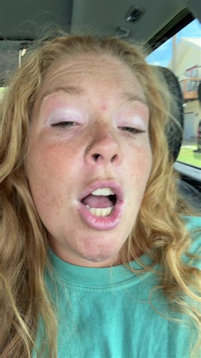 Ginger Cuties: Embracing Chubby Charm