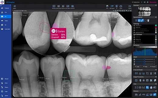 How to use Planmeca Romexis with Second Opinion service