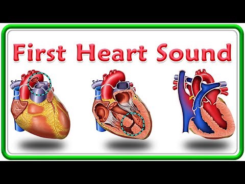 First Heart Sound (1st Heart sound) : Intensity, Wide splitting of S1 and Reverse splitting of S1
