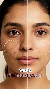 Niacinamide Seum Benefits | Niacinamide Seum Review | how to use nicinamide serum Dr Sunil Kothiwala