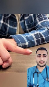 Digital clubbing, characterized by the enlargement and rounding of the fingertips, is often associated with underlying medical conditions such as chronic lung diseases (bronchiectasis, cystic fibrosis), heart conditions (congenital heart disease, endocarditis), gastrointestinal diseases (inflammatory bowel disease, cirrhosis), and certain infections. The exact mechanism involves chronic hypoxia leading to vasodilation and increased blood flow to the fingertips, resulting in tissue growth. Digita