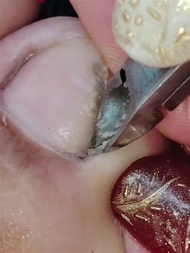 Lấy khoé siêu phê #laykhoe #laykhoemong #laykhoemongchan #laykhoechan #taovamich