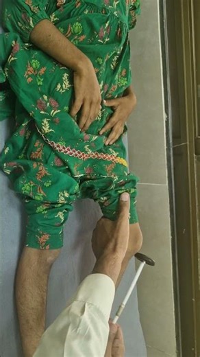 Rare Synkinesis Reflex: Knee Tap Triggers Elbow Reflex | Crossed Knee–Elbow Reflex #NeurologyCase