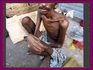 Watch this video of Indian poor peoples or slum area peoples