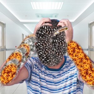 197K views · 715 reactions | ASMR and maggot satisfying hand face wash Remove | Asmr Sakir Medical | Facebook