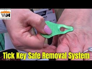 Safely Remove Wood Ticks From Pets and Children with Tick Key Removal System| Weekend Handyman