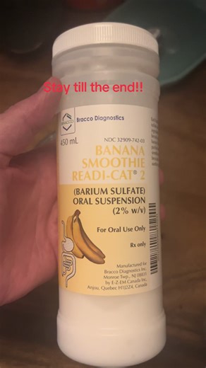 My Shocking Reaction to the Barium Test!