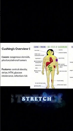Skinny Legs, Big Belly? A Nurse Explains Cushing’s Syndrome