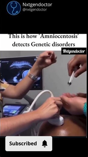 “How Amniocentesis Is Done #Amniocentesis#PrenatalTest#NursingStudents#MedicalEducation#PregnancyCar