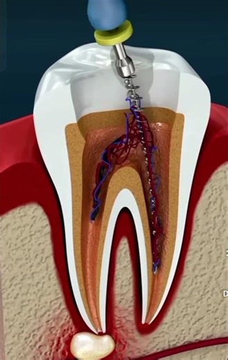 RCT kese hoti animation se samjhe