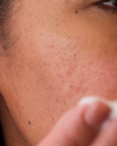 2.5K views · 36 reactions | Talk about feel-good factor! Our Calm + Restore™ Redness Relief Foaming Cleanser is everything sensitive skin needs: ❤️ Visibly reduces the look of redness 殺 Instantly soothes irritated skin 﫧 Fragrance-free + tested to be gentle Learn More: https://www.aveeno.com/products/calm-restore-redness-relief-foaming-cleanser | Aveeno | Facebook