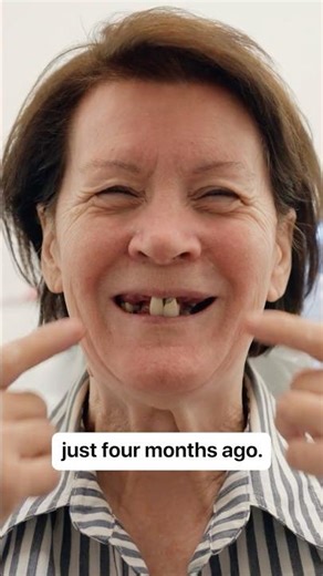 I Didn’t Expect This After Getting New Teeth in 24 Hours