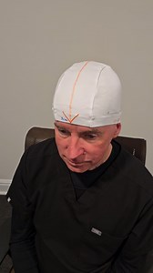 OCD Motor Threshold Video Training