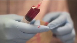 Will a pig's organs replace human organ donation and ease the transplant wait list?