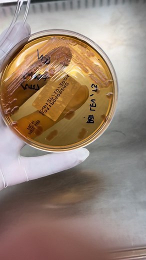 Stenotrophomonas maltophilia: Tìm hiểu Vi Sinh Học