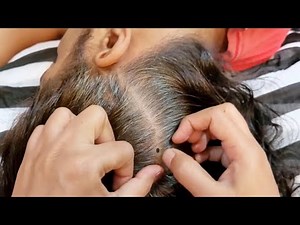 ASMR ✨ Intense Lice Check & Hair Pulling For Instant Sleep 💤😴 ( Real Person)