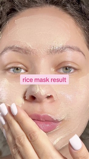 A rice mask is usually made from boiled rice. Rice contains natural starch. This can help the skin feel calmer and this why a lot of people say that it makes their skin so soft. It can also help absorb excess oil on the surface of the skin. That is why people with acne prone skin often feel some comfort after using it. Rice also contains small amounts of antioxidants. These help protect the skin from daily stress like pollution and friction. It really does something for acne prone skin. It also 