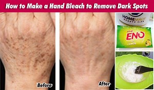 435K views · 1.4K reactions | How to Make a Hand Bleach to Remove Dark Spots #diy #darkspots #blackheads #bleach #handbleach | Homemade Beauty Tip | Facebook