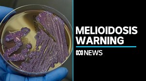 NT Health issues warning amid spike in melioidosis cases