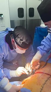 Back Lift - Bra Line Back Lift (GRAPHIC)