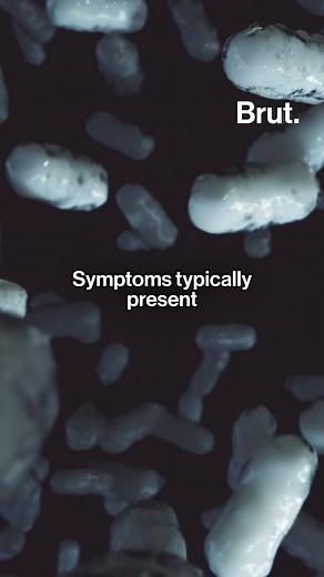 Wolverine Packing Co. has recalled over 167,000 pounds of ground beef after 15 cases of E. coli have been linked to their products. It is recommended that contaminated products are not consumed, or are cooked to a temperature of 160 degrees Fahrenheit to kill potential bacteria. #GroundBeefRecall #GroundBeef #Hamburger #Ecoli #Recall #Food #FSIS | Brut