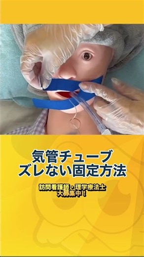 【気管チューブ】ズレないテープ固定方法 補助なし【訪問看護】