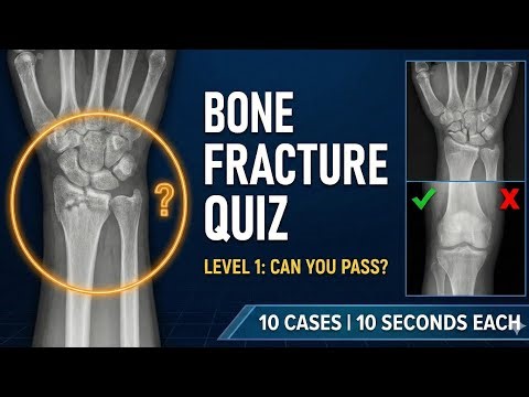 Test Your X-Ray Eyes: 10 Common Fractures. (Most Miss #9!)#radiology#medical#xray#fractures