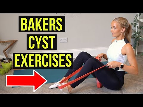 5 exercises for a Bakers Cyst (Popliteal Cyst) | Doctor and Physio led