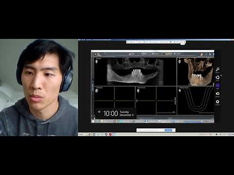 How to Export CBCT DICOM from Sidexis 4 Dental